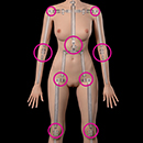 General Weakness Joint Tightness