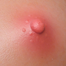 Pink Areola