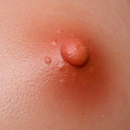 Light Brown Areola