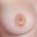 4cm Areola Size