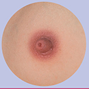 Light Brown Areola