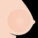 Gel-Filled Breast Optionss