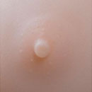 Skin Areola Color